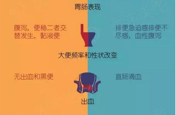 秒懂｜肠易激综合征 与 炎症性肠病 的区别