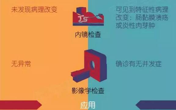 秒懂｜肠易激综合征 与 炎症性肠病 的区别