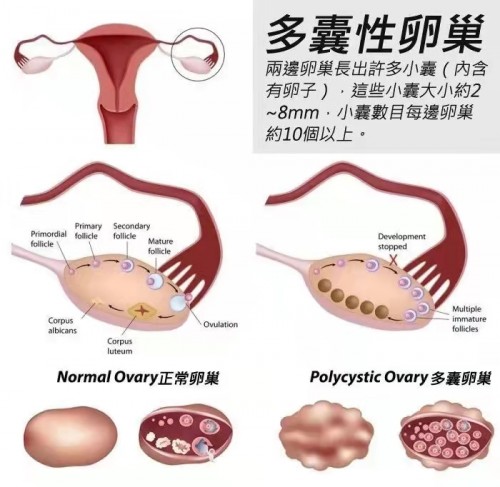 多囊姐妹圈里爆火的知昕益角豆荔枝饮到底是什么？