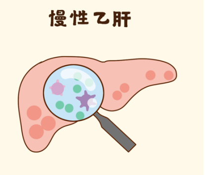 慢性乙肝及增强免疫调节首选用药——迈普新胸腺法新的作用是什么？