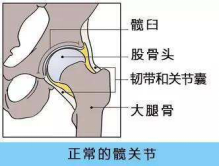 髋关节镜技术治疗——“非手术”微创解限保髋防残